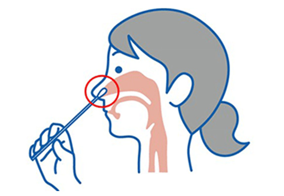 画像：鼻腔（鼻前庭/前鼻孔）  鼻の入り口1-2cm付近から、医師監督下で自己採取が可能