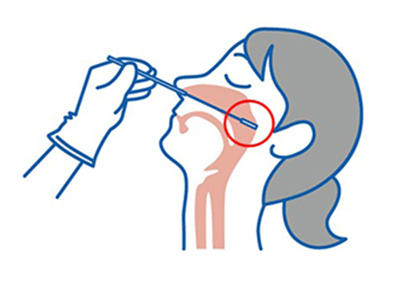 画像：鼻咽頭  医療従事者により、鼻の奥から採取